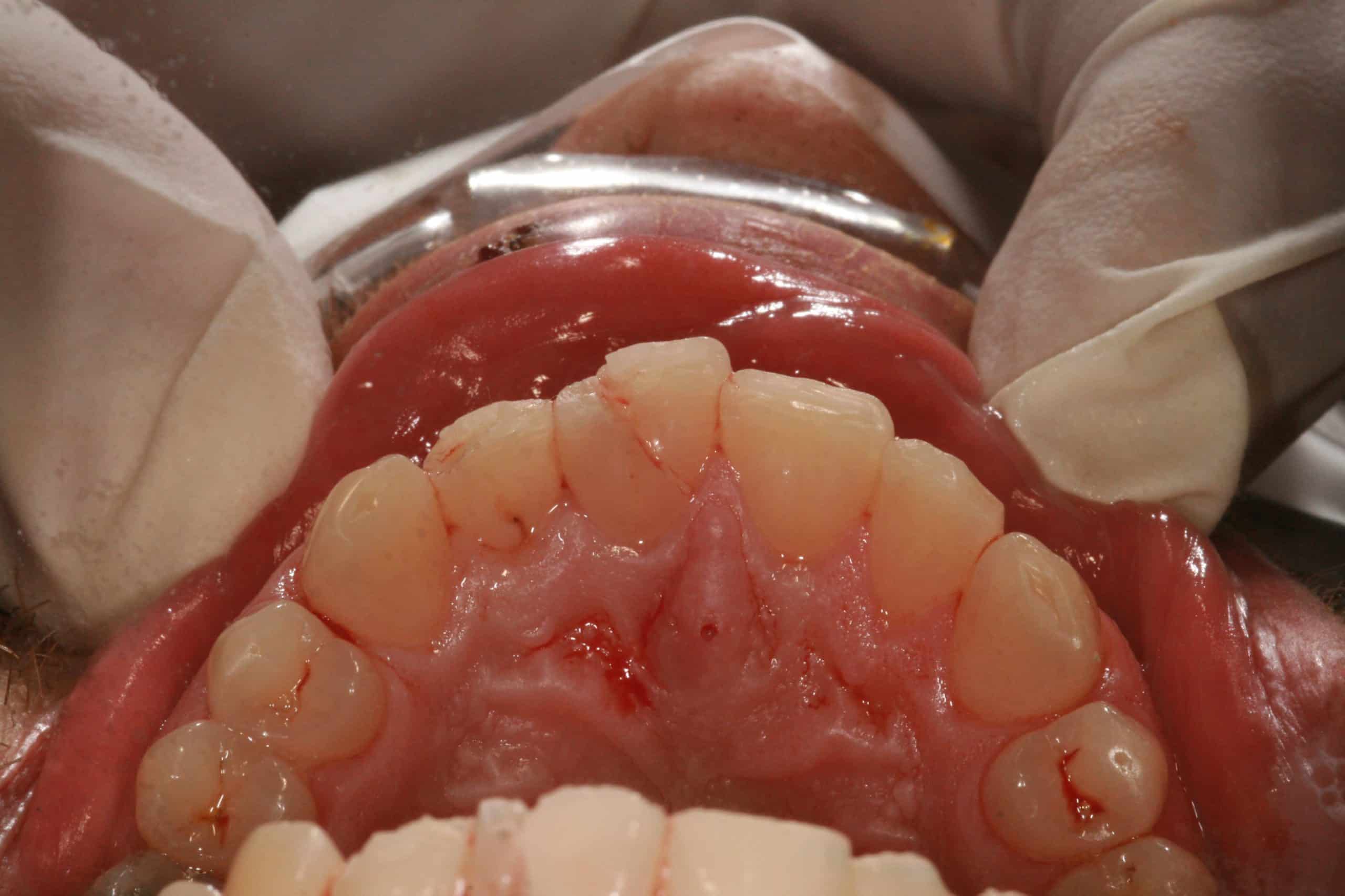 Dental Oral Issues Advanced Dentistry & Dental Implant Center