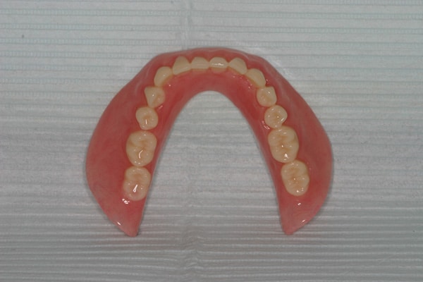 Complete mandibular denture