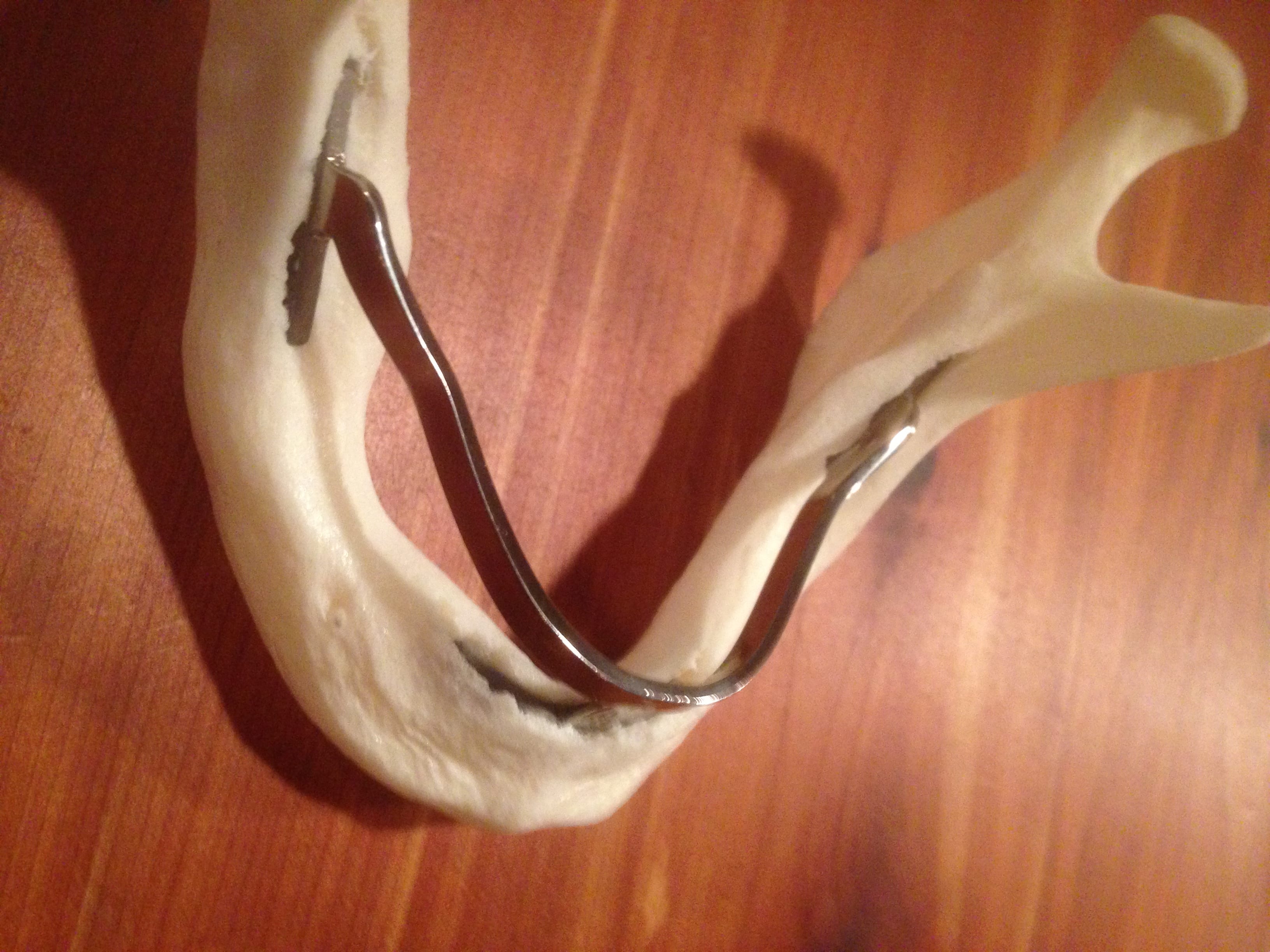 Ramus Frame Advanced Dentistry & Dental Implant Center