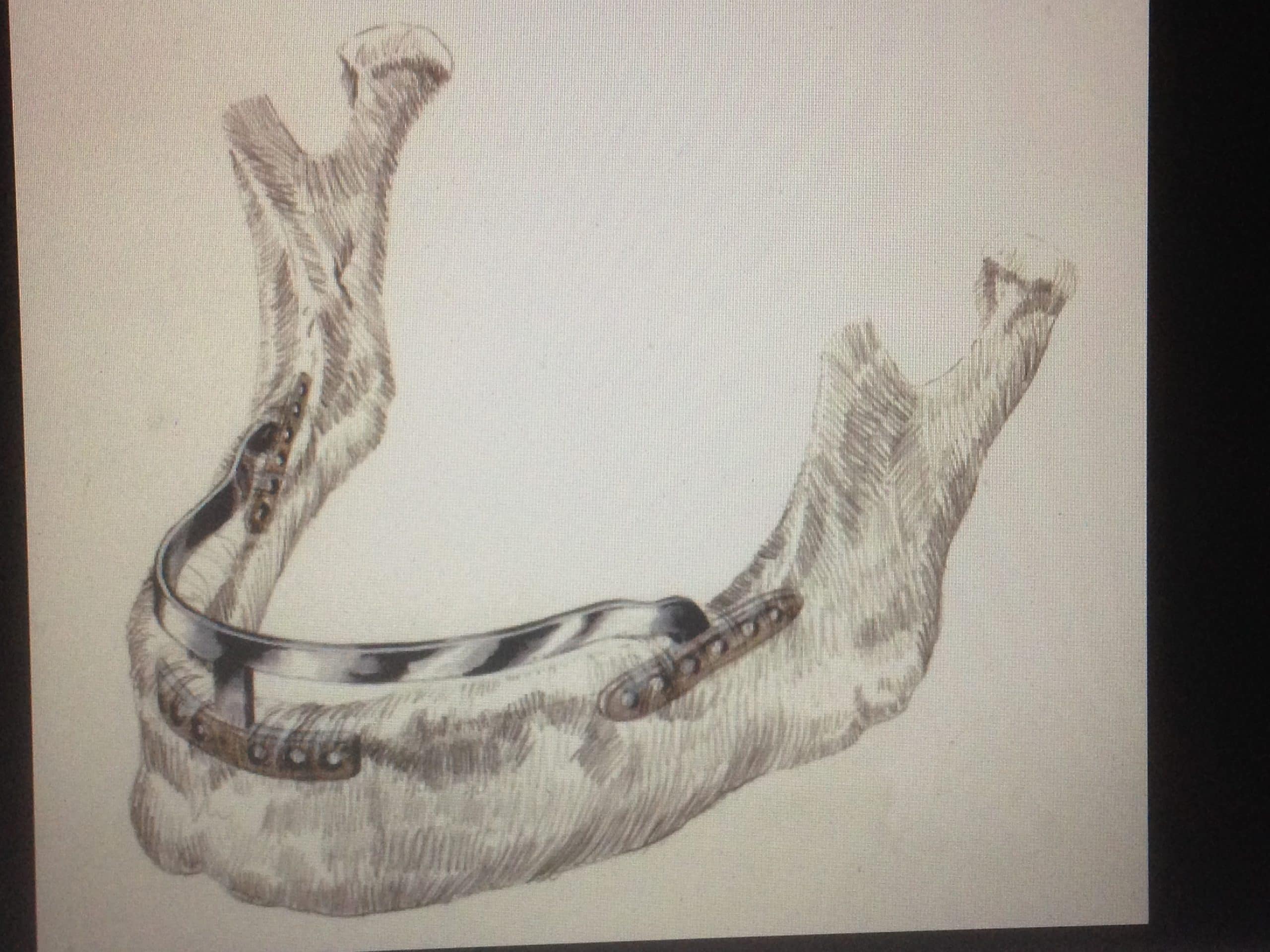 Ramus Frame Advanced Dentistry & Dental Implant Center