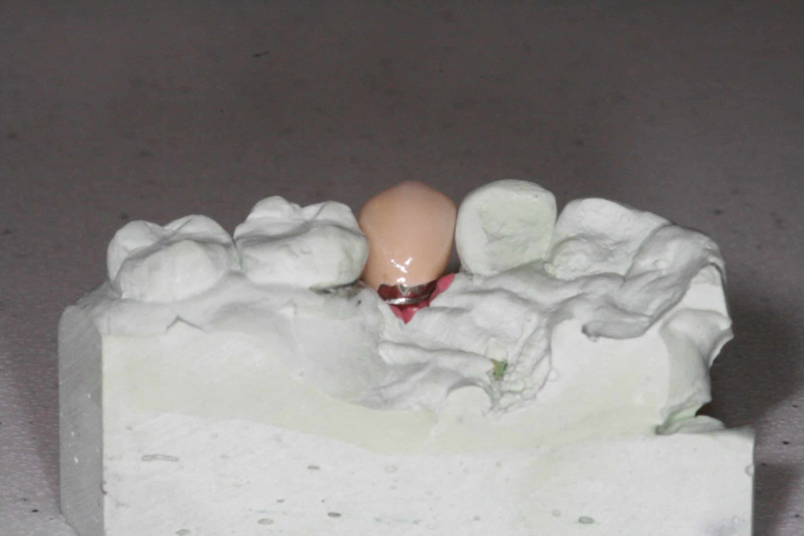 Canine Implant Crown Advanced Dentistry & Dental Implant Center