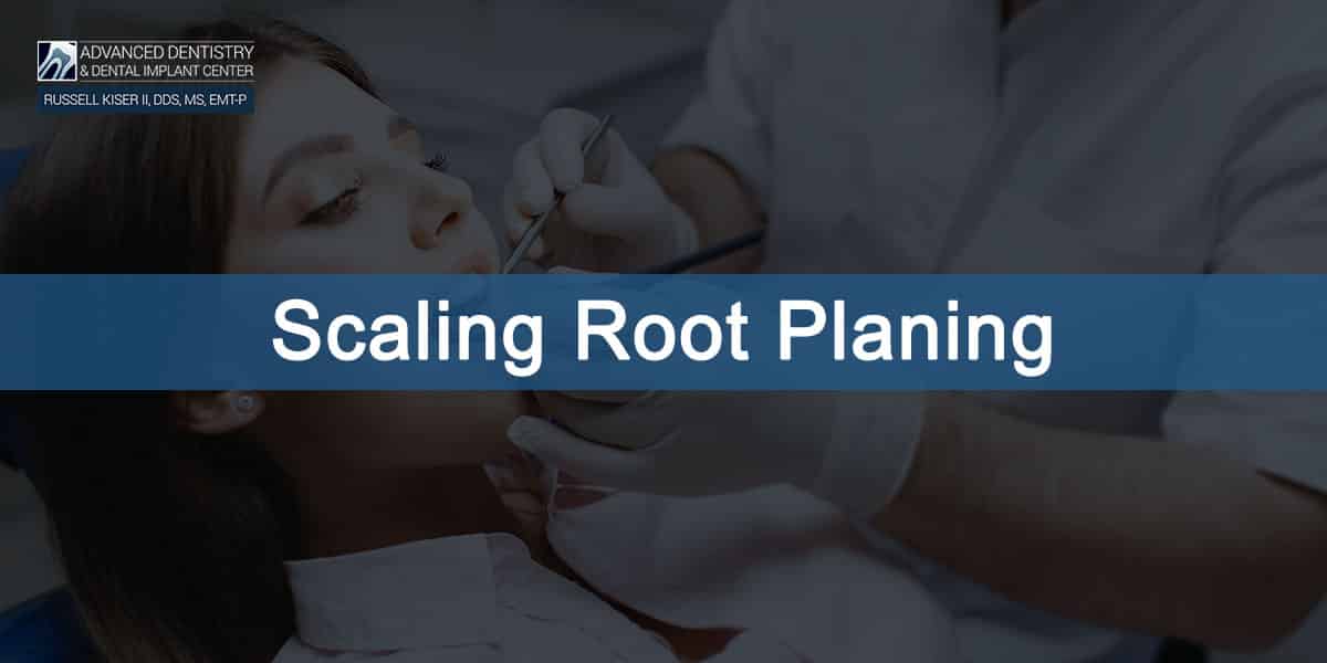 Scaling and Root Planing - Advanced Dentistry & Dental Implant Center