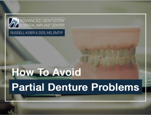How to Avoid Partial Denture Problems