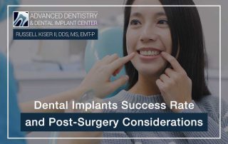 Dental Implants Success Rate And Post-Surgery Considerations