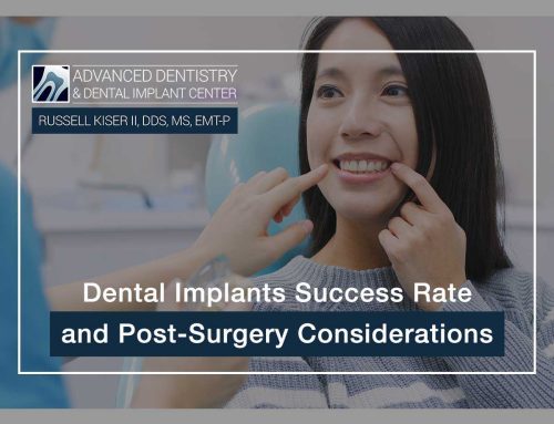 Dental Implants Success Rate And Post-Surgery Considerations