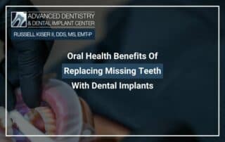 Oral Health Benefits Of Replacing Missing Teeth With Dental Implants