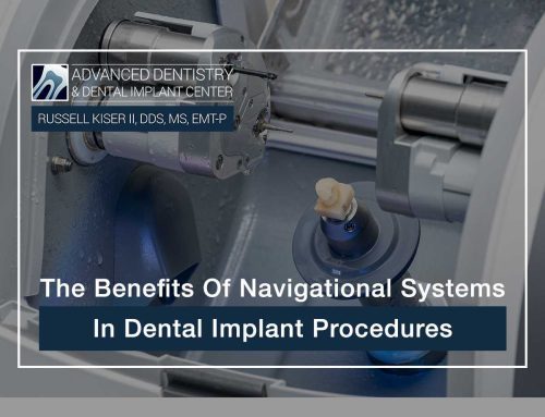 The Benefits Of Navigational Systems In Dental Implant Procedures