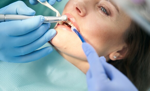 Root Canal Procedure In Mansfield