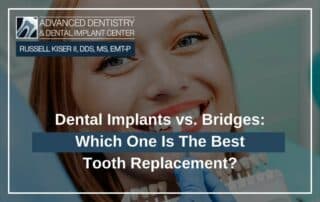 Dental Implants vs. Bridges Which One Is The Best Tooth Replacement