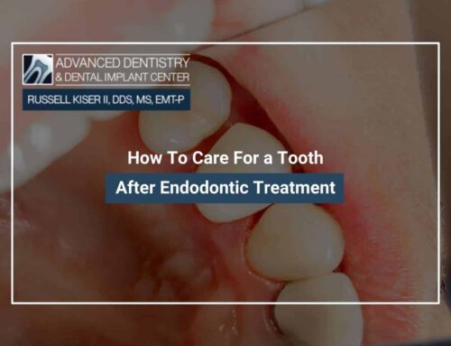 How To Care For a Tooth After Endodontic Treatment