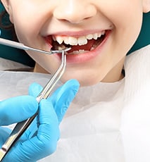 You Might Need Dental Bridges If You Have Shifting or Loose Teeth