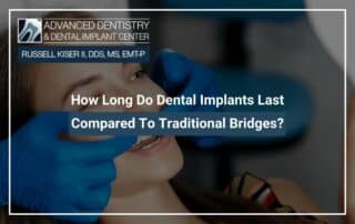 How Long Do Dental Implants Last Compared To Traditional Bridges?