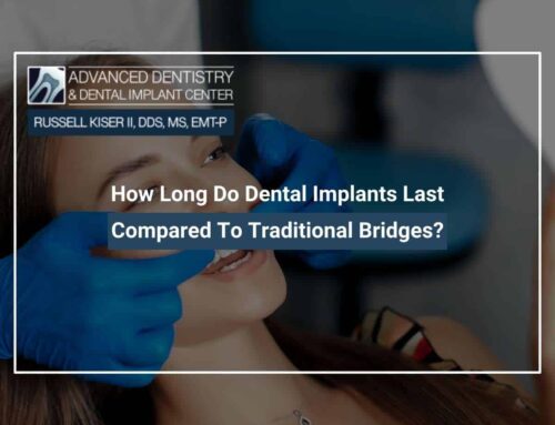 How Long Do Dental Implants Last Compared To Traditional Bridges?