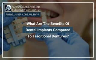 What Are The Benefits Of Dental Implants Compared To Traditional Dentures?