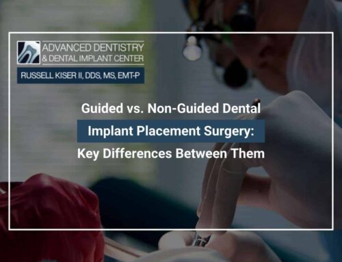 Guided vs. Non-Guided Dental Implant Placement Surgery: Key Differences Between Them