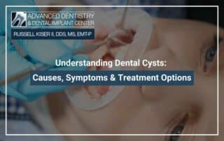 Understanding Dental Cysts: Causes, Symptoms & Treatment Options