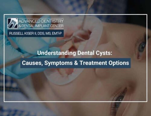 Understanding Dental Cysts: Causes, Symptoms & Treatment Options