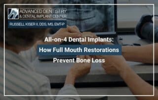 All-on-4 Dental Implants: How Full Mouth Restorations Prevent Bone Loss