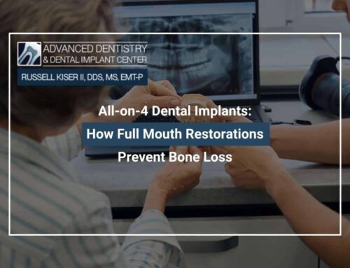 All-on-4 Dental Implants: How Full Mouth Restorations Prevent Bone Loss