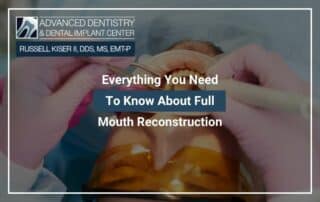 Everything You Need To Know About Full Mouth Reconstruction