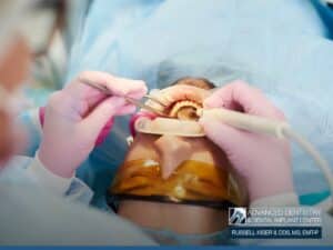 Dentist performing mouth reconstruction procedure at Advanced Dentistry